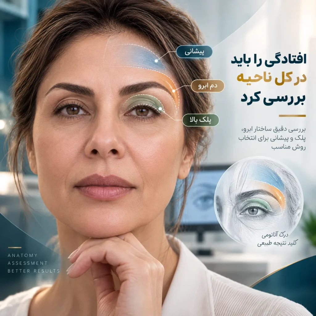 جراحی لیفت دم ابرو چیست؟