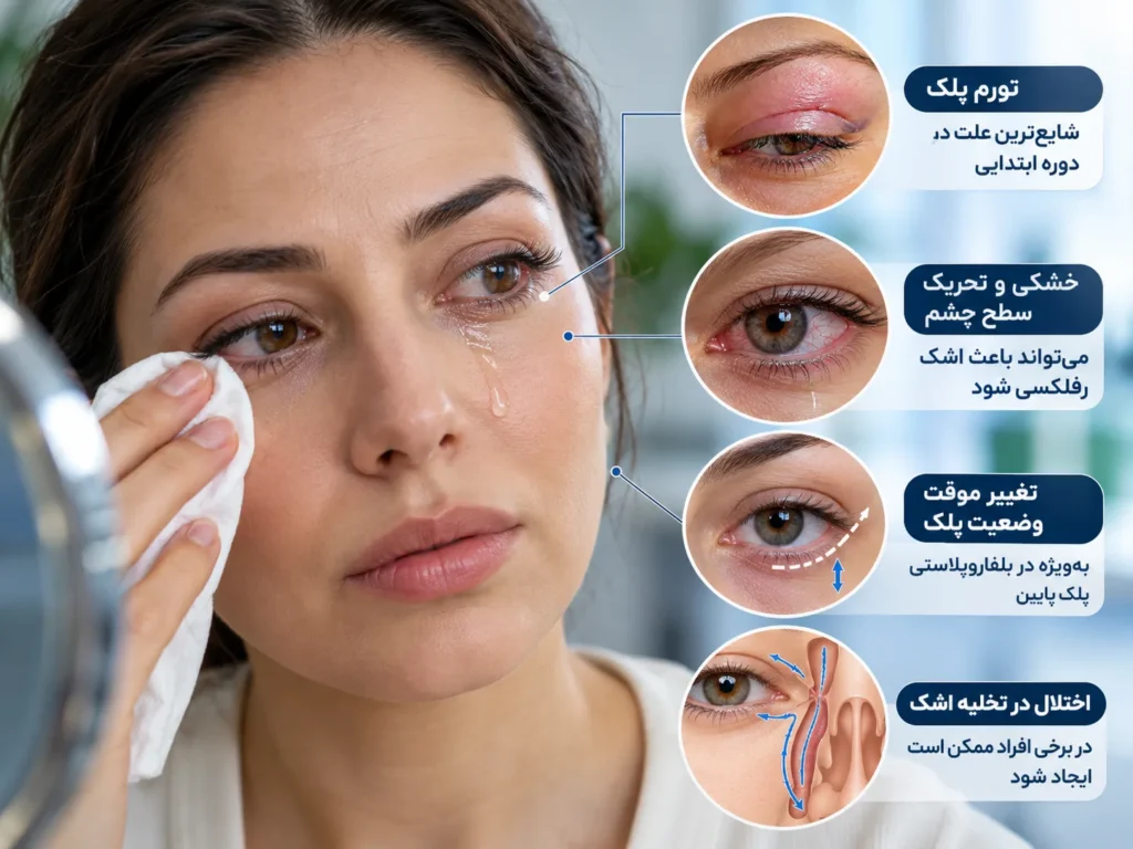 علت آبریزش چشم بعد از بلفاروپلاستی چیست ؟