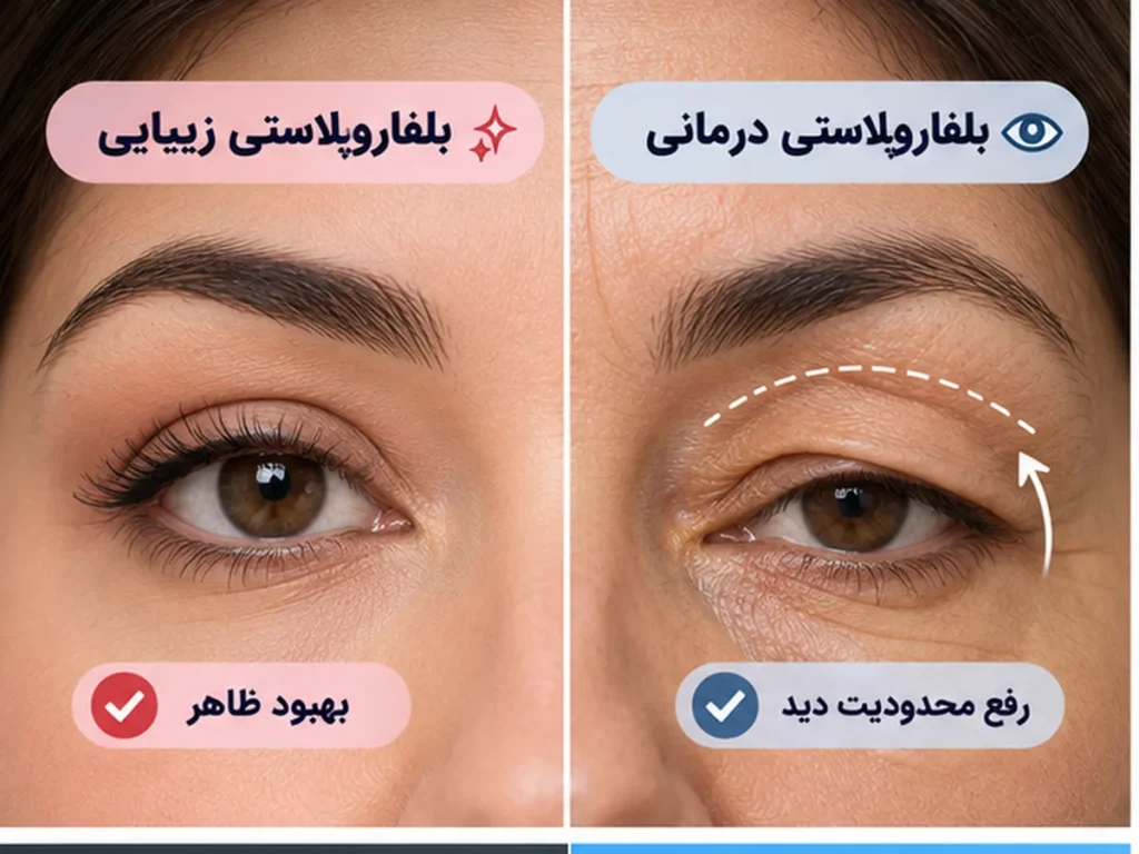 بلفاروپلاستی زیبایی و درمانی چه تفاوتی دارند؟