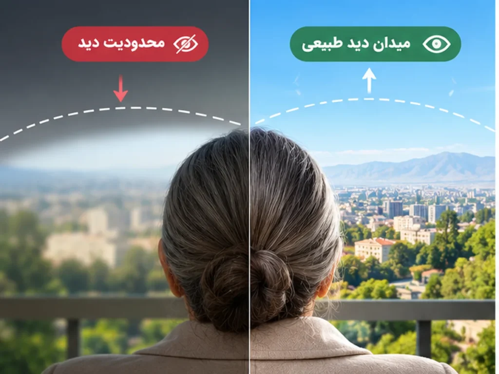 بلفاروپلاستی زیبایی و درمانی چه تفاوتی دارند؟