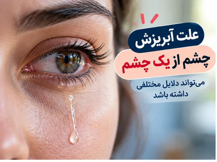علت آبریزش چشم از یک چشم چیست؟